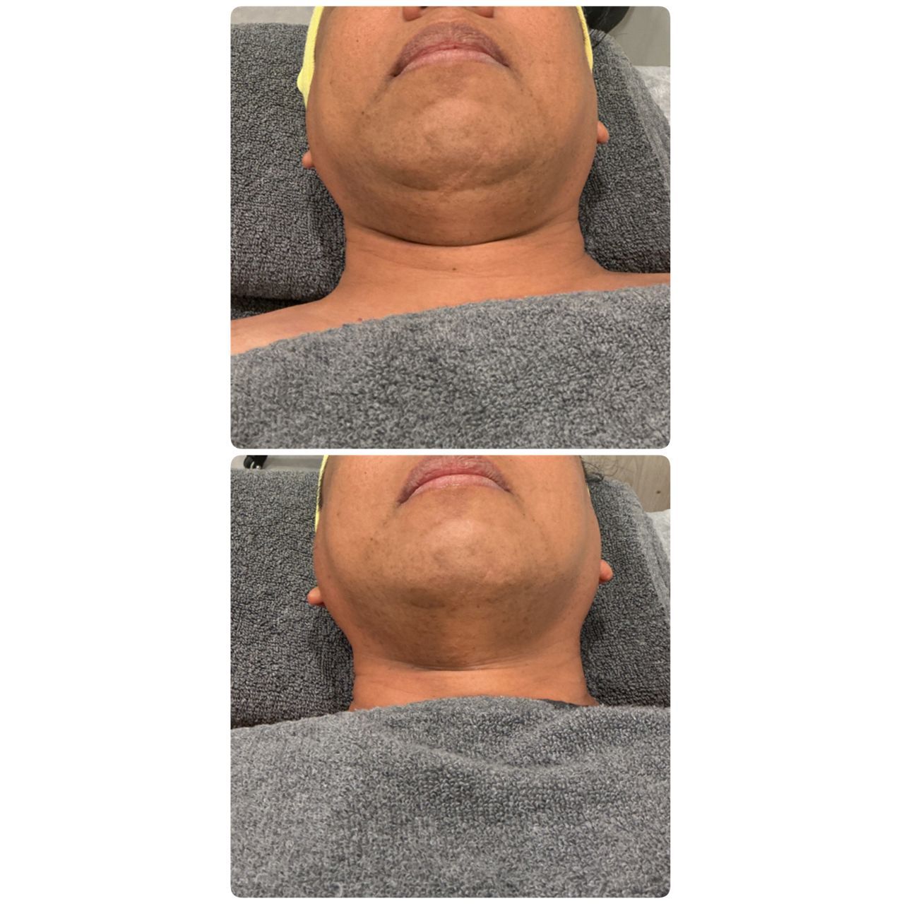 JEMOJE  - Quantum Glow Skin Brightening 