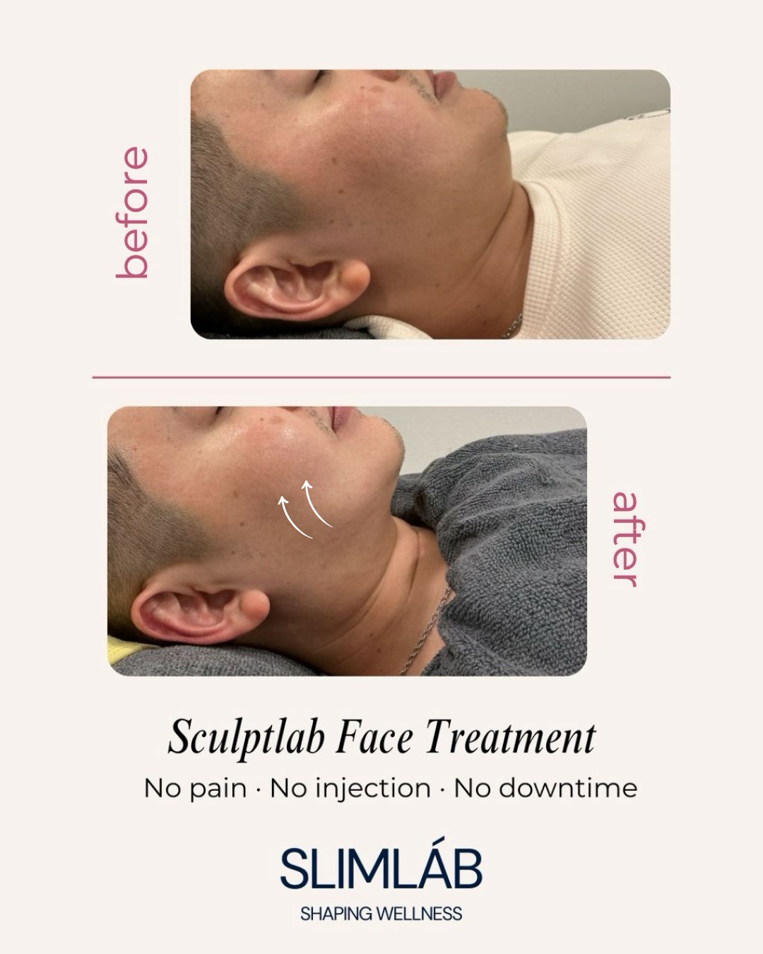 JEMOJE  - Quantum Glow Skin Brightening 